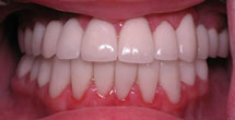 Healthy brilliantly white teeth