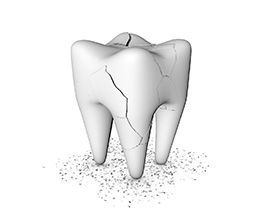 3D render of a broken tooth