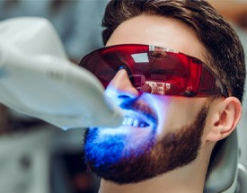 Closeup of man getting professional Opalescence Boost in-office whitening treatment in Cumming