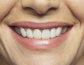 Closeup of smile with natural looking dentures