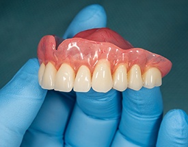 Denture dentist in Cumming holding top arch for a denture.