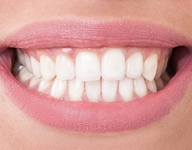 Closeup of smile with healthy teeth and gums