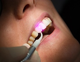 Patient receiving laser dental care
